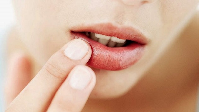 agar bibit tdk hitam